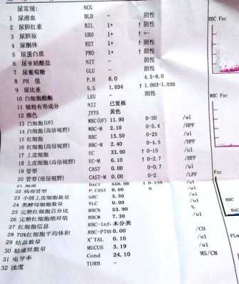 孕期尿常规检查(孕期尿常规检查需要空腹吗) 第3张 孕期尿常规检查(孕期尿常规检查需要空腹吗) 第3张