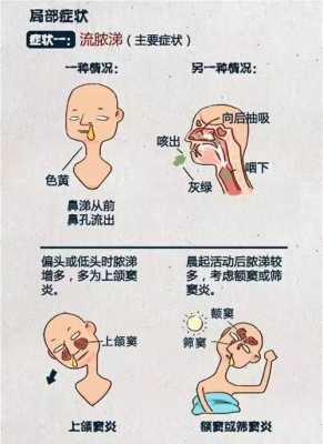 孕期鼻炎鼻塞怎么办,怀孕期间鼻塞严重怎么办 第2张 孕期鼻炎鼻塞怎么办,怀孕期间鼻塞严重怎么办 第2张