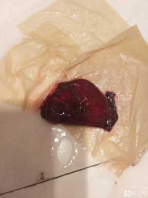 怀孕期间血块(怀孕期间血块像块肉一样是什么) 第2张 怀孕期间血块(怀孕期间血块像块肉一样是什么) 第2张