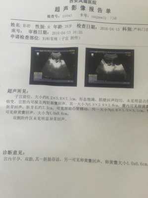 怀孕80天有孕吐反应是胎儿发育好吗?还没去做产检,上次检查,80天胎儿发育图片大全 第2张 怀孕80天有孕吐反应是胎儿发育好吗?还没去做产检,上次检查,80天胎儿发育图片大全 第2张