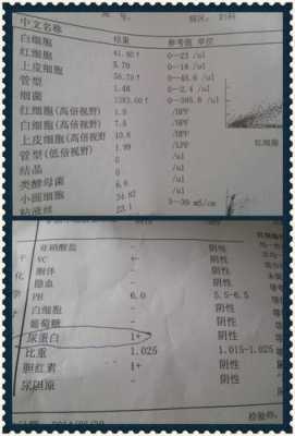 孕期尿蛋白一个加号(从怀孕33周到38周一直尿蛋白1+) 第2张 孕期尿蛋白一个加号(从怀孕33周到38周一直尿蛋白1+) 第2张