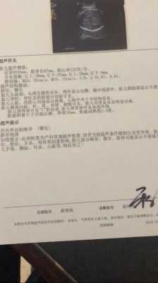 孕期检查sd是什么意思(孕期检查sd是什么意思啊) 第3张 孕期检查sd是什么意思(孕期检查sd是什么意思啊) 第3张