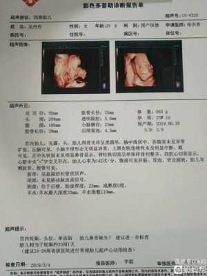 24周胎儿鼻骨正常值是多少,胎儿二十四周发育标准图片 第1张 24周胎儿鼻骨正常值是多少,胎儿二十四周发育标准图片 第1张