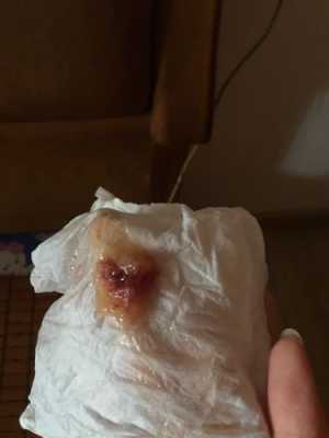 孕期吐痰带血什么原因(孕期吐痰带血什么原因引起的) 第1张 孕期吐痰带血什么原因(孕期吐痰带血什么原因引起的) 第1张