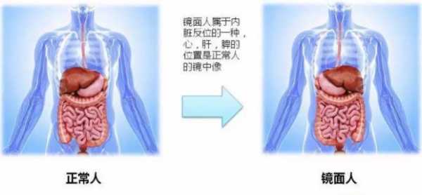 镜子宝宝是什么意思,胎儿镜面人是什么意思 第1张 镜子宝宝是什么意思,胎儿镜面人是什么意思 第1张