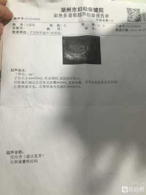 妊娠线偏左怎么回事,胎儿偏左边是什么原因 第2张 妊娠线偏左怎么回事,胎儿偏左边是什么原因 第2张