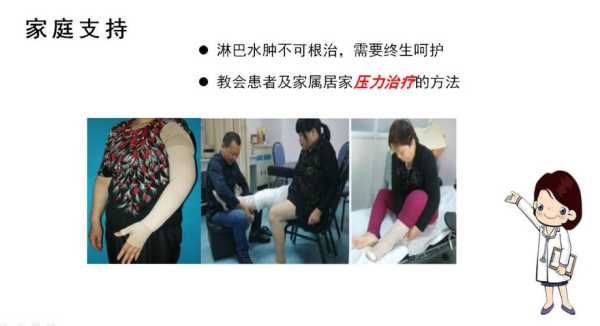 淋巴水肿的治疗方法,胎儿淋巴水肿还能要吗 第2张 淋巴水肿的治疗方法,胎儿淋巴水肿还能要吗 第2张