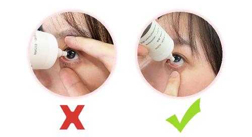 怀孕期间可以滴眼药水吗（怀孕期间可以滴眼药水吗有影响吗）  第2张