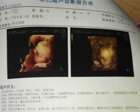 怀孕胎儿偏小2周(b超显示孕周比实际小是什么原因) 第2张 怀孕胎儿偏小2周(b超显示孕周比实际小是什么原因) 第2张
