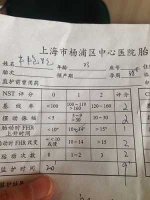 胎儿fhr是什么意思（胎儿FHR是什么意思呢）  第2张