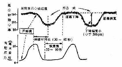 胎儿fhr是什么意思（胎儿FHR是什么意思呢）  第3张