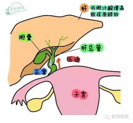 孕期胆囊部位疼痛怎么办,孕期胆於的症状  第1张