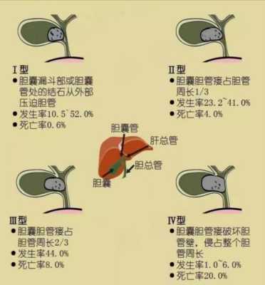 孕期胆囊部位疼痛怎么办,孕期胆於的症状  第2张