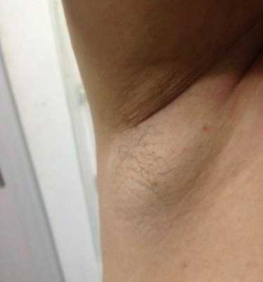 孕期腋下肿大(孕期腋下肿大是怎么回事) 第3张 孕期腋下肿大(孕期腋下肿大是怎么回事) 第3张