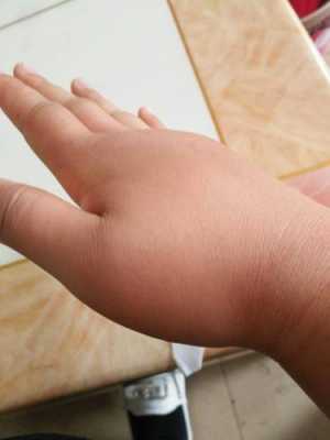 孕期右手肿(孕妇手肿是什么原因) 第2张 孕期右手肿(孕妇手肿是什么原因) 第2张