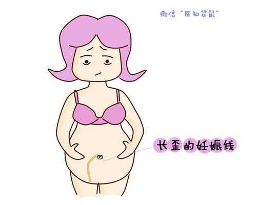 怀孕几个月有妊娠线,孕期肚脐线歪的  第3张