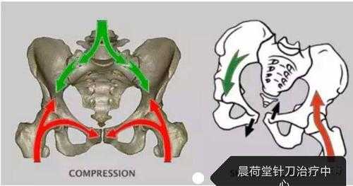 孕期阴阳腿(孕期阴阳腿是什么原因) 第2张 孕期阴阳腿(孕期阴阳腿是什么原因) 第2张