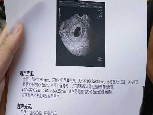 什么是孕囊？孕囊的作用是什么,胎儿胚囊大小对照表  第2张
