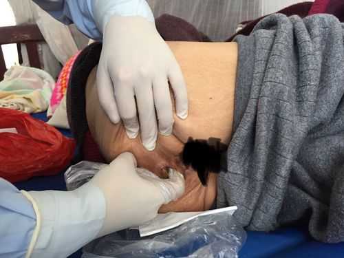 孕期抠大便(孕妇换尿布的正确方法) 第3张 孕期抠大便(孕妇换尿布的正确方法) 第3张