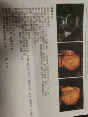 胎儿半握拳(胎儿半握拳状态是什么意思) 第3张 胎儿半握拳(胎儿半握拳状态是什么意思) 第3张