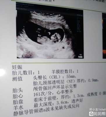 胎儿nt值多少是男孩(胎儿NT值多少是男孩女孩) 第2张 胎儿nt值多少是男孩(胎儿NT值多少是男孩女孩) 第2张