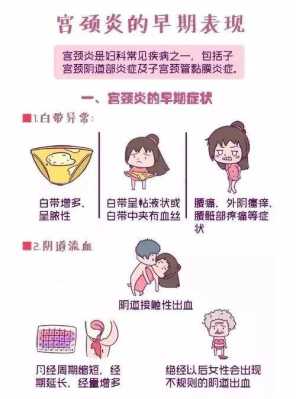 孕期有宫颈炎(宫颈炎的表现症状,能自己调理吗) 第1张 孕期有宫颈炎(宫颈炎的表现症状,能自己调理吗) 第1张