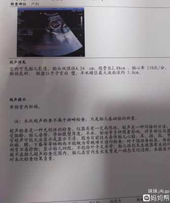 怀孕19周胎儿彩超图(19+周什么意思) 第3张 怀孕19周胎儿彩超图(19+周什么意思) 第3张