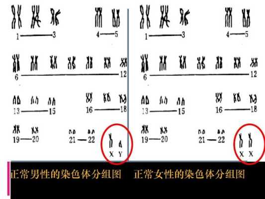染色体对胎儿的影响(染色体对胎儿的影响发生时间) 第1张 染色体对胎儿的影响(染色体对胎儿的影响发生时间) 第1张