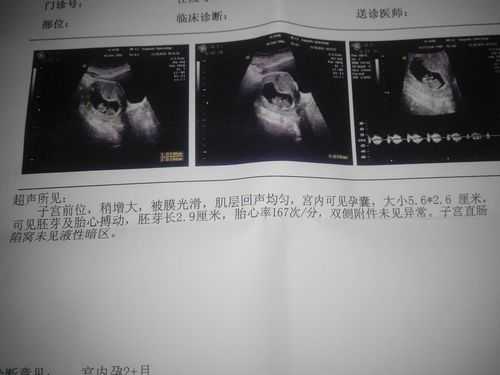怀孕二十二周胎儿多大(怀孕22周胎心一直104左右正常吗) 第2张 怀孕二十二周胎儿多大(怀孕22周胎心一直104左右正常吗) 第2张