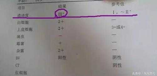霉菌阴道炎能顺产吗,孕期有霉菌可以顺产吗有影响吗 第1张 霉菌阴道炎能顺产吗,孕期有霉菌可以顺产吗有影响吗 第1张