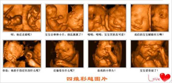孕期二级筛查(孕妇28周到32周做二级四维彩超主要检查胎儿什么) 第3张 孕期二级筛查(孕妇28周到32周做二级四维彩超主要检查胎儿什么) 第3张