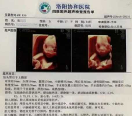 宝宝畸形产检能检查出来吗?一般多大可以检查出来,胎儿畸形几率大吗 第2张 宝宝畸形产检能检查出来吗?一般多大可以检查出来,胎儿畸形几率大吗 第2张