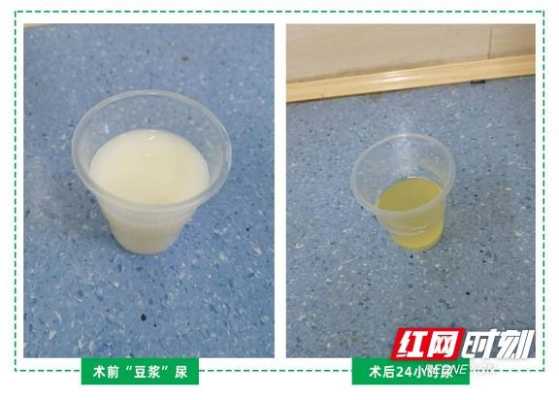 孕期尿黄味大怎么回事(怀孕两个月尿很黄怎么回事) 第2张 孕期尿黄味大怎么回事(怀孕两个月尿很黄怎么回事) 第2张