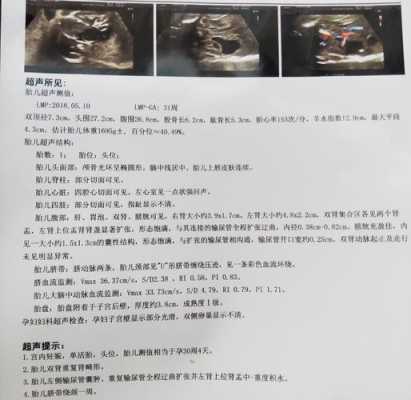 胎儿肾有泡(胎儿肾有泡泡怎么办) 第1张 胎儿肾有泡(胎儿肾有泡泡怎么办) 第1张