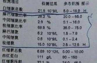 白细胞高中性粒细胞高是怎么回事,孕期中性粒细胞百分比偏高说明什么问题 第2张 白细胞高中性粒细胞高是怎么回事,孕期中性粒细胞百分比偏高说明什么问题 第2张