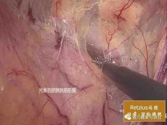 腹壁裂胎儿图片(蜘蛛腹部裂了一个口子如何挽救呀) 第2张 腹壁裂胎儿图片(蜘蛛腹部裂了一个口子如何挽救呀) 第2张
