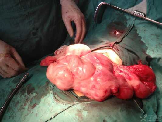 腹壁裂胎儿图片(蜘蛛腹部裂了一个口子如何挽救呀) 第1张 腹壁裂胎儿图片(蜘蛛腹部裂了一个口子如何挽救呀) 第1张