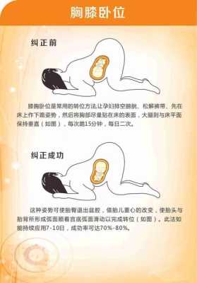 孕妇趴着调整胎位该怎么做好,如何让胎儿胎位不正呢 第1张 孕妇趴着调整胎位该怎么做好,如何让胎儿胎位不正呢 第1张