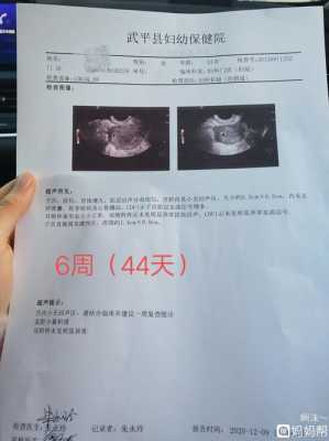 阴超会对宝宝有影响吗,怀孕了做阴超对胎儿有影响吗 第1张 阴超会对宝宝有影响吗,怀孕了做阴超对胎儿有影响吗 第1张