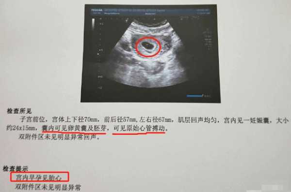 阴超会对宝宝有影响吗,怀孕了做阴超对胎儿有影响吗 第2张 阴超会对宝宝有影响吗,怀孕了做阴超对胎儿有影响吗 第2张