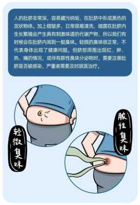 孕期肚脐臭(孕期肚脐臭是怎么回事) 第3张 孕期肚脐臭(孕期肚脐臭是怎么回事) 第3张