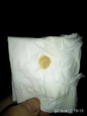 孕期痰好多(孕期痰很多) 第2张 孕期痰好多(孕期痰很多) 第2张