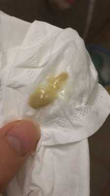 孕期痰好多(孕期痰很多) 第1张 孕期痰好多(孕期痰很多) 第1张