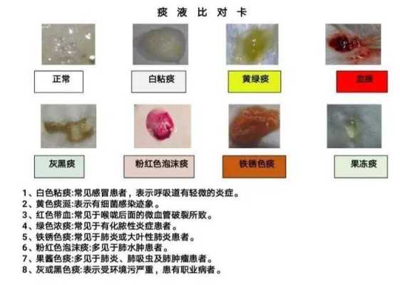 孕37周喉咙痛有黄痰,会感染胎儿吗,孕妇咳黄痰对胎儿影响孕晚期 第1张 孕37周喉咙痛有黄痰,会感染胎儿吗,孕妇咳黄痰对胎儿影响孕晚期 第1张