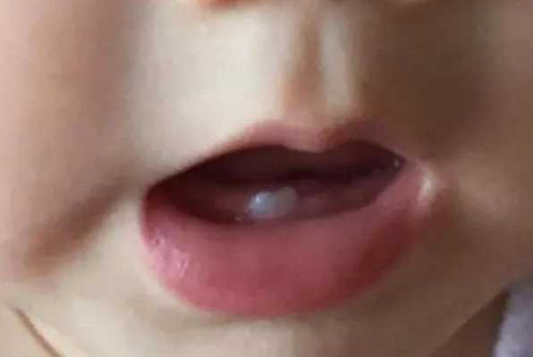 四个月宝宝长牙有什么症状,四个月胎儿样子图片 第1张 四个月宝宝长牙有什么症状,四个月胎儿样子图片 第1张