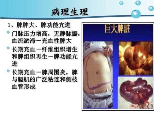 胎儿脾肿大(胎儿脾肿大的原因和危害) 第1张 胎儿脾肿大(胎儿脾肿大的原因和危害) 第1张