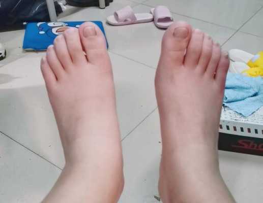 脚胖是哪样的,孕期脚胖了还能恢复吗 第2张 脚胖是哪样的,孕期脚胖了还能恢复吗 第2张