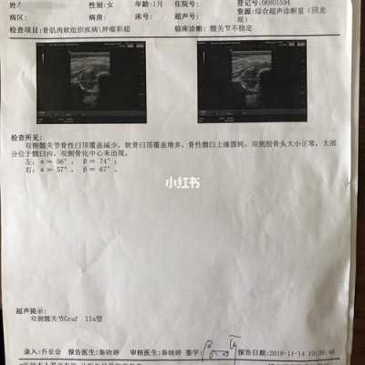 胎儿髋关节（胎儿髋关节脱位四维能发现吗）  第2张