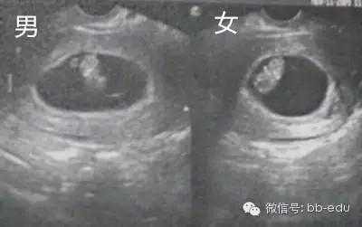 怀孕鉴定胎儿性别(怀孕鉴定胎儿性别准吗) 第1张 怀孕鉴定胎儿性别(怀孕鉴定胎儿性别准吗) 第1张