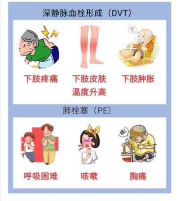 孕期血栓高(孕期血栓高会有什么后果?) 第2张 孕期血栓高(孕期血栓高会有什么后果?) 第2张